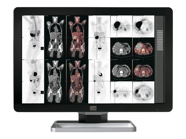 Barco Coronis Fusion 6MP LED MDCC-6230 - LED monitor - 6MP - color - 30.4" - with Barco MXRT-5550 graphics adapter