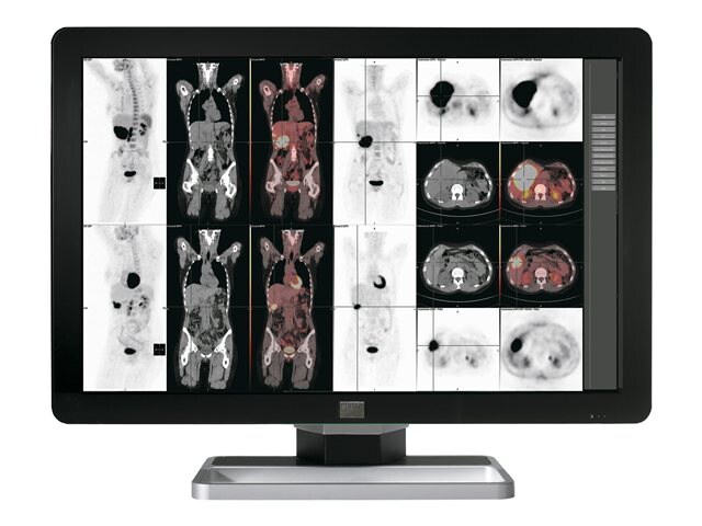 Barco Coronis Fusion 6MP LED MDCC-6230 - LED monitor - 2 x 6MP - color - 30.4" - with Barco MXRT-5500 graphics adapter