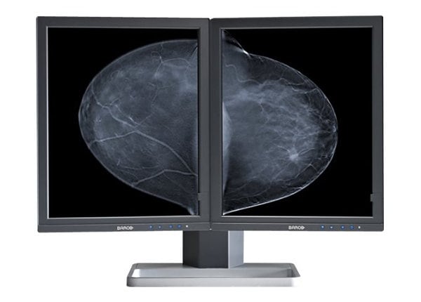 Barco Mammo Tomosynthesis 5MP MDMG-5221 - LCD monitor - 5MP - grayscale - 21.3" - with Barco MXRT-5500 graphics adapter
