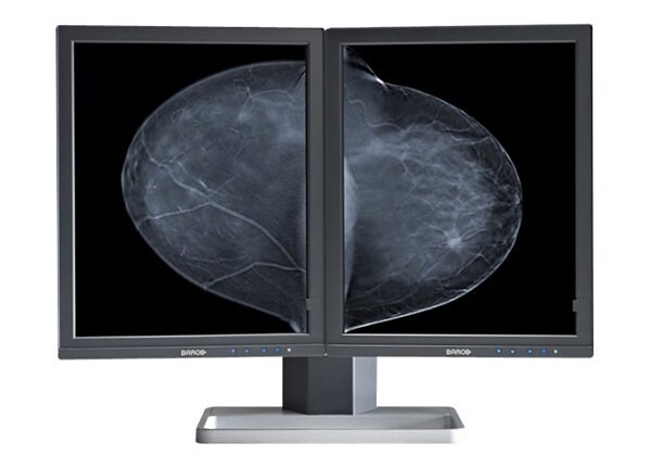 Barco Mammo Tomosynthesis 5MP MDMG-5221 - LCD monitor - 5MP - grayscale - 21.3" - with Barco MXRT-5550 graphics adapter