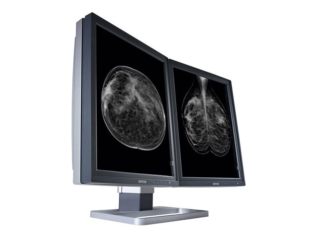 Barco Mammo Tomosynthesis 5MP MDMG-5221 - LCD monitor - 5MP - grayscale - 21.3" - with Barco MXRT-5550 graphics adapter