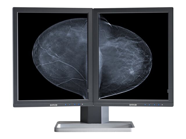 Barco Mammo Tomosynthesis 5MP MDMG-5221 - LCD monitor - 4 x 5MP - grayscale - 21.3" - with Barco MXRT-5550 graphics
