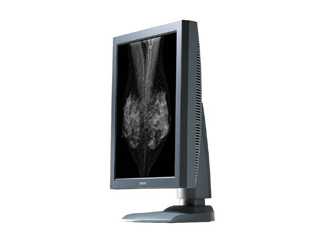Barco Coronis 5MP Mammo MDMG-5121 - LCD monitor - 2 x 5MP - grayscale - 21.3" - with Barco MXRT-5500 graphics adapter