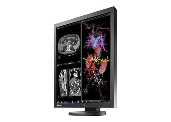 EIZO RadiForce MX215-BK - LED monitor - 2MP - color - 21.3"