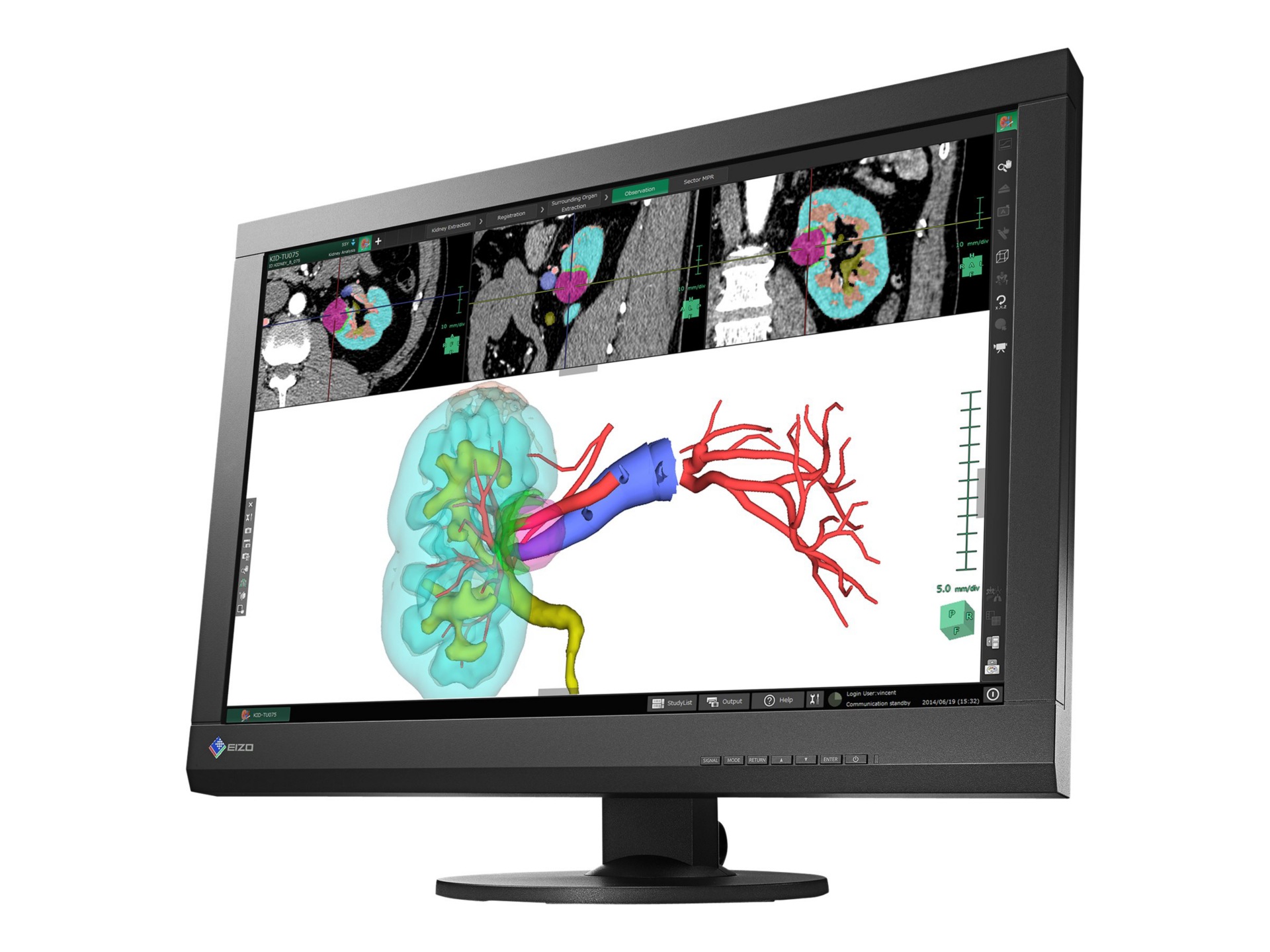 EIZO RadiForce MX242W - LED monitor - 24.1"