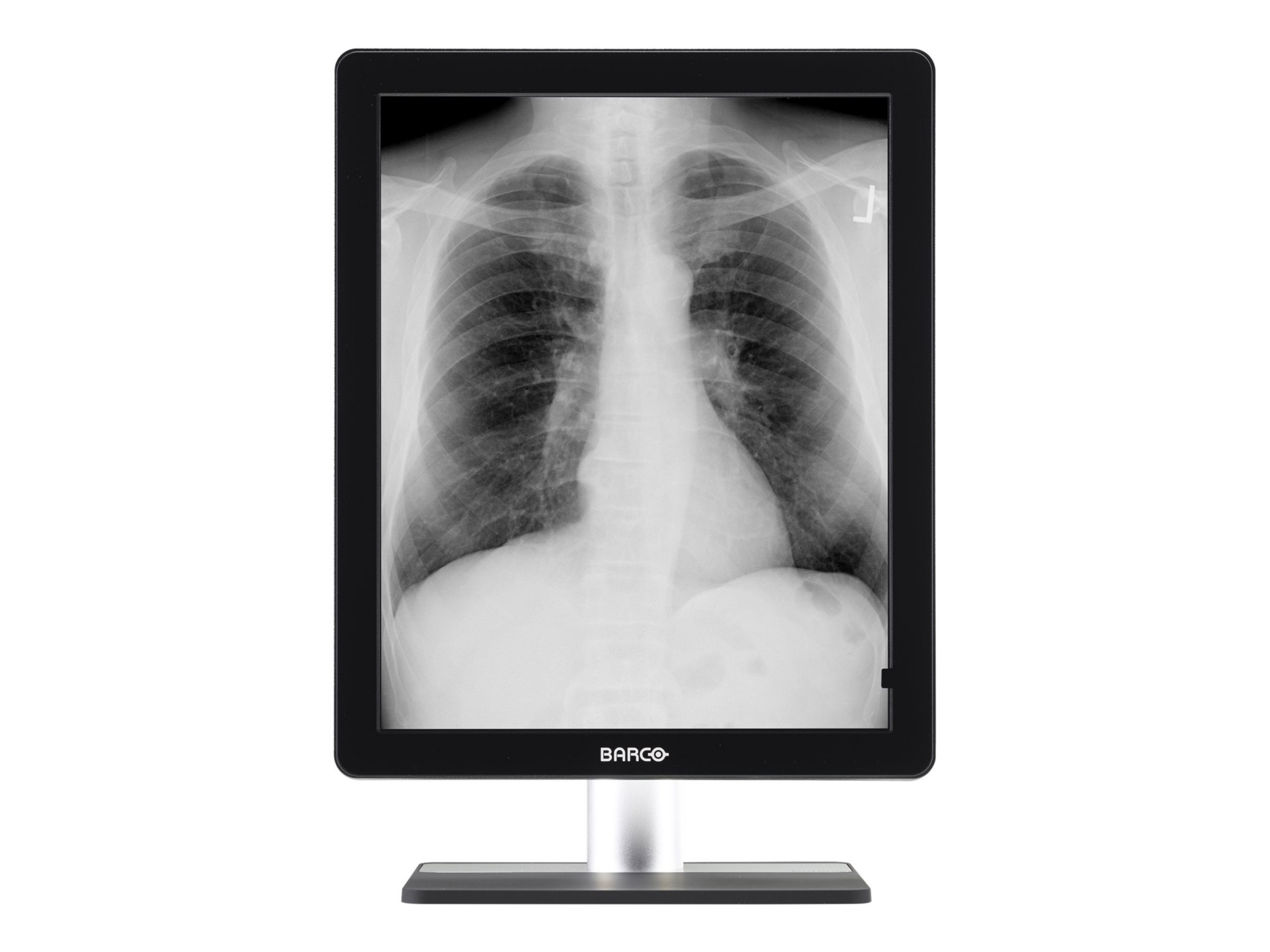 Barco Coronis 5MP LED MDCG-5221 - LED monitor - 2 x 5MP - grayscale - 21.3"