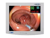 RADIANCE G2 - LED monitor - color - 19"