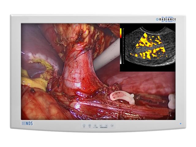 NDS Radiance G2 24" Color LED Display w/ Single Fiber w/ Touch