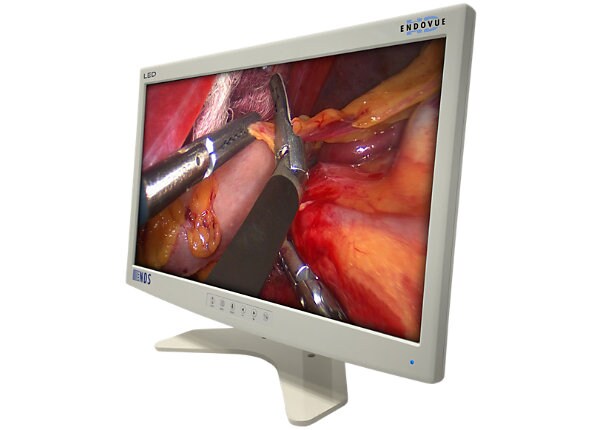 NDS Surgical Imaging Endovue 21" LED Surgical Monitor