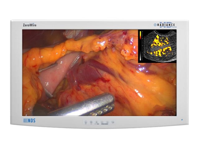 RADIANCE G2 HB - LED monitor - Full HD (1080p) - color - 26"