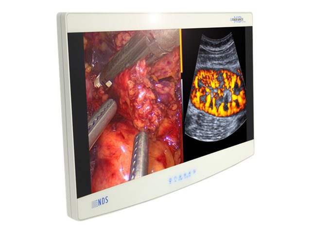 NDS Radiance Ultra 27" Color LED Display w/ Secondary Analog Board