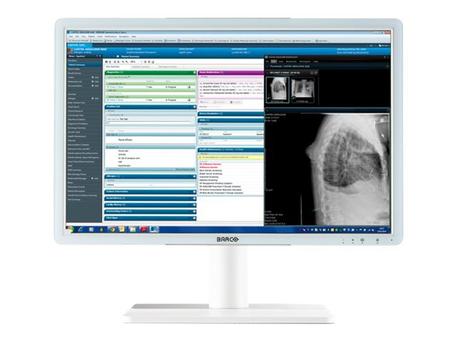 BARCO EONIS 24" MDRC-2224 WH 2MP CLINICAL DISPLAY WHITE NO PROT GLASS COVER