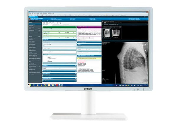 BARCO EONIS 24" MDRC-2224 WH 2MP CLINICAL DISPLAY WHITE NO PROT GLASS COVER