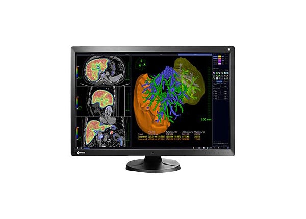 EIZO RadiForce RX650 Single Head - LED monitor - 6MP - color - 30" - with NVIDIA Quadro M2000 graphics adapter