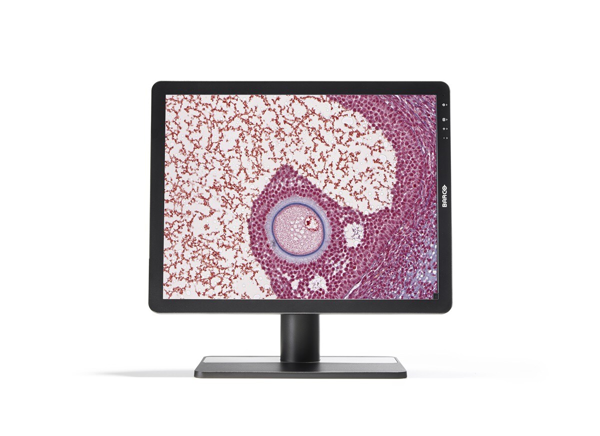 HP Eonis MDRC-2221 2MP LED Monitor