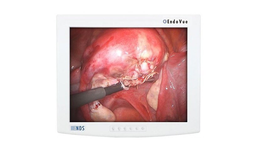 NDSSI EndoVue 21" LED Surgical Monitor