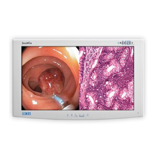 NDS Surgical Imaging Radiance G3 26" Monitor