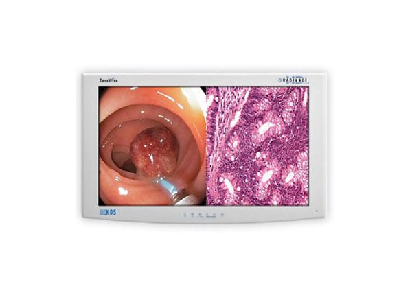 NDS Surgical Imaging Radiance G3 26" Monitor