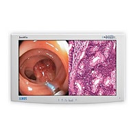 NDS Surgical Imaging Radiance G3 26" Monitor