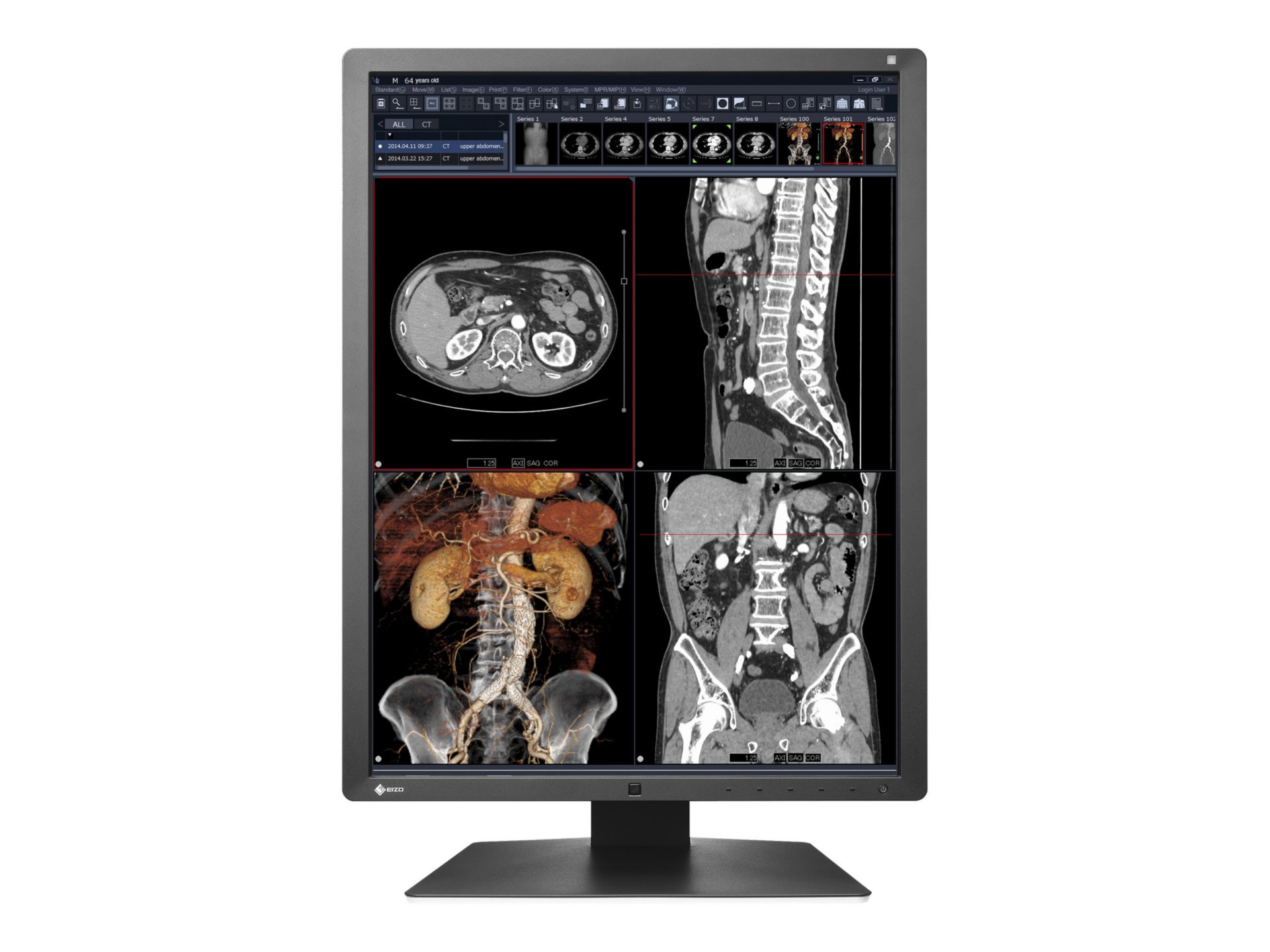 EIZO RadiForce RX250 Single Head - LED monitor - 2MP - color - 21.3"