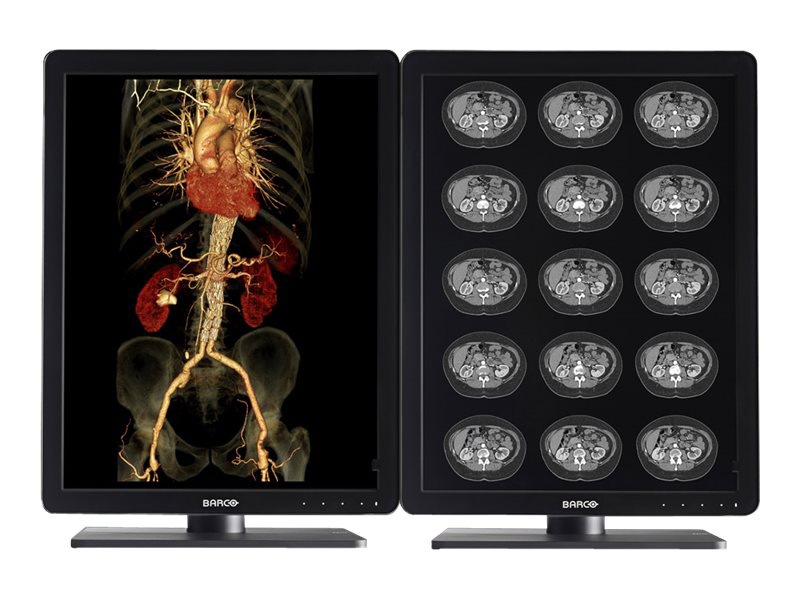 Barco Nio Color 3MP MDNC-3421 - LED monitor - 3MP - color - 21.3"