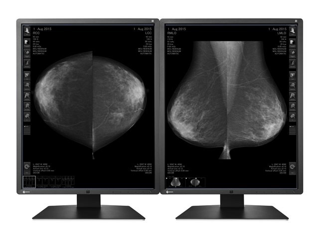 EIZO RadiForce GX550-DH-AW510 - LED monitor - 5MP - grayscale - 21.3" - with AMD FirePro W5100 graphics adapter