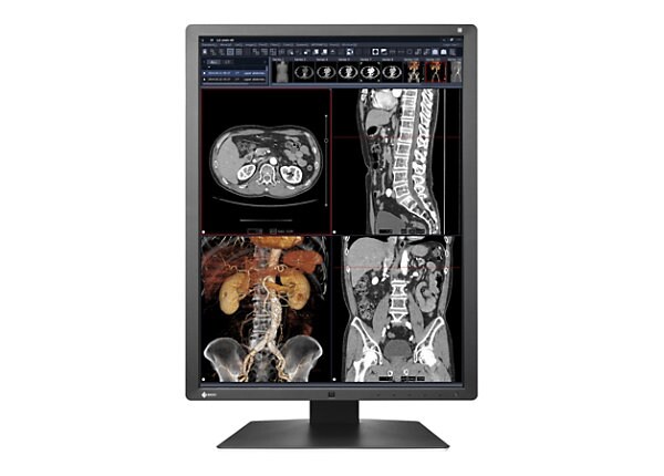 EIZO RadiForce RX250 Single Head - LED monitor - 2MP - color - 21.3" - with AMD FirePro W4100 graphics adapter