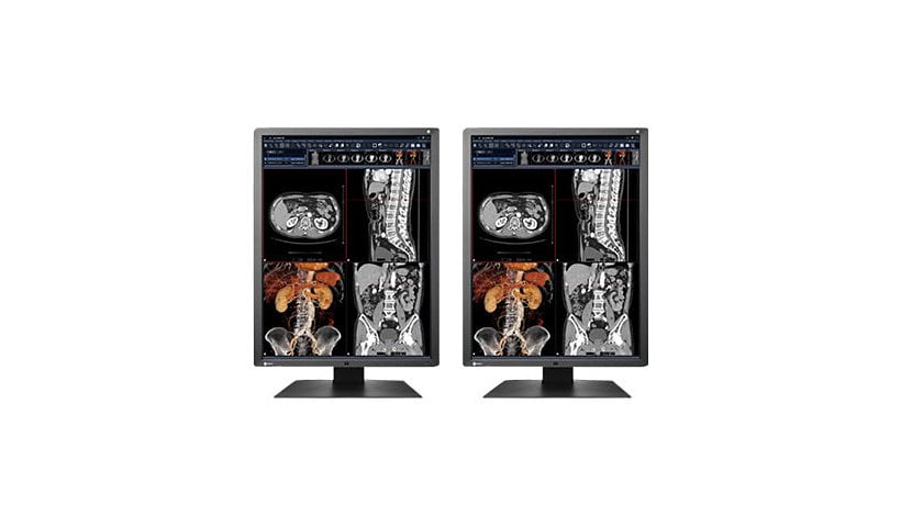 EIZO RadiForce RX250 Dual Head - LED monitor - 2MP - color - 21.3" - with N
