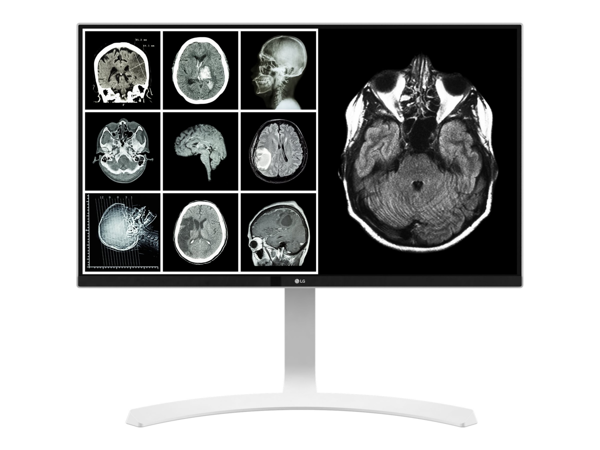 LG 27HJ712C-W 27" Class 4K UHD LCD Monitor - 16:9 - White - TAA Compliant
