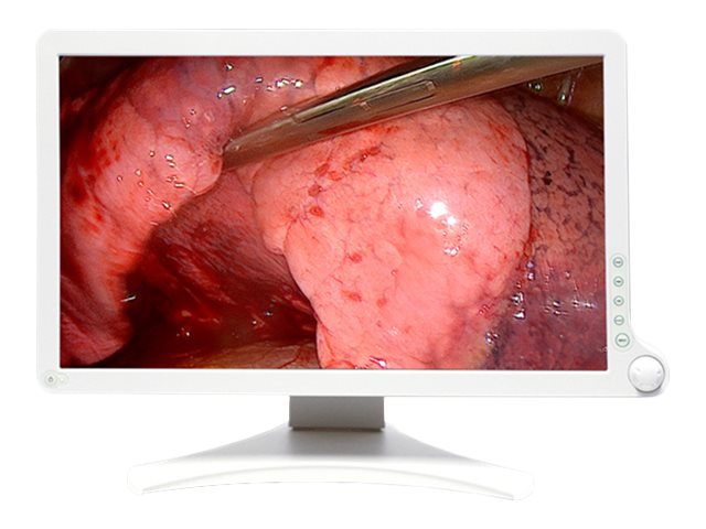 BARCO 21.5" FULL HD SURGICAL GRADE TOUCH DISPLAY FOR OR/ENDO AMM 215WTTP