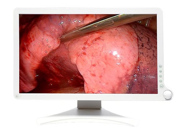 BARCO 21.5" FULL HD SURGICAL GRADE TOUCH DISPLAY FOR OR/ENDO AMM 215WTTP