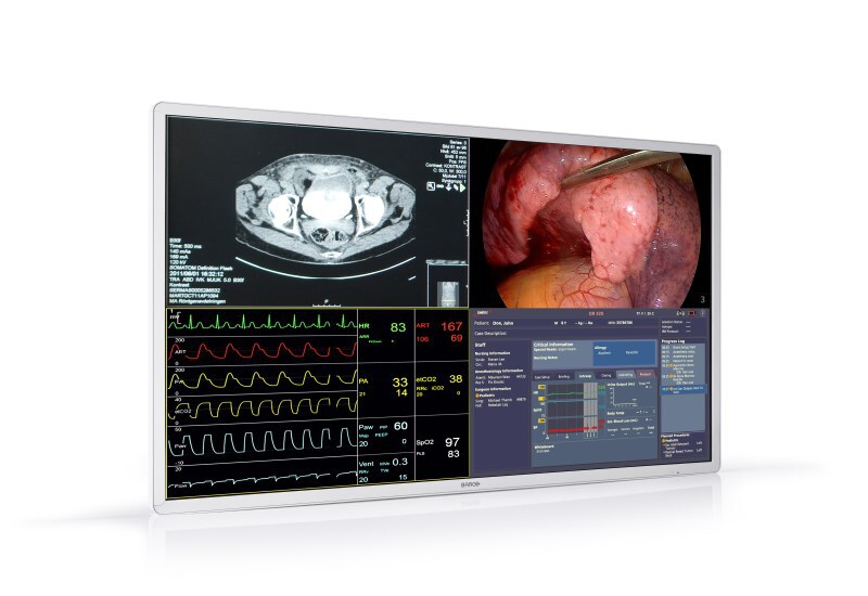 HP Barco MDSC-8255 4K UHD Large Screen Surgical Display