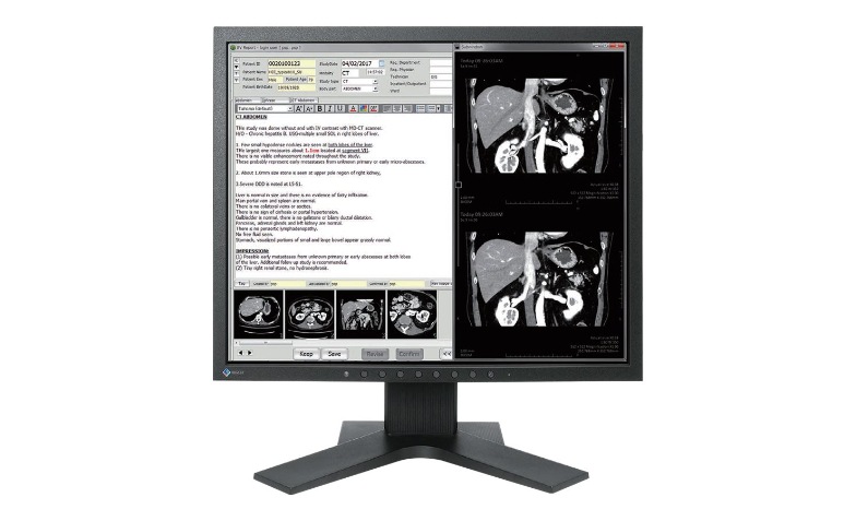EIZO RadiForce MX194 - LED monitor - 1MP - color - 19
