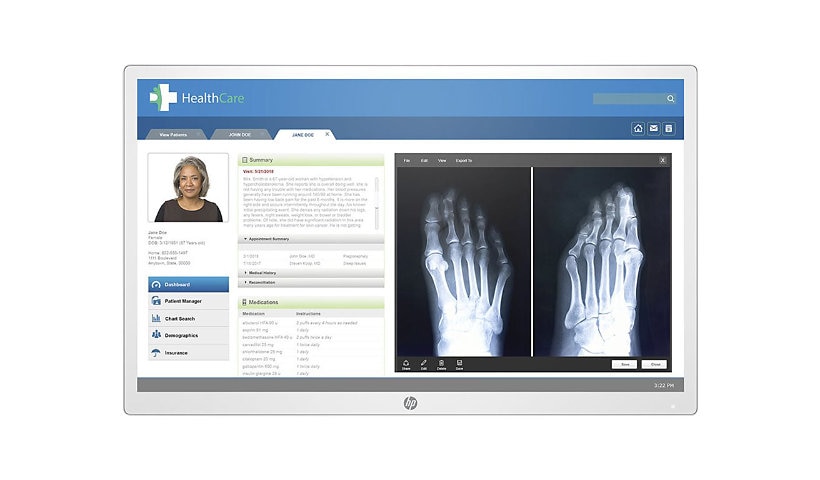HP HC271p Clinical Review Monitor - Head Only, Healthcare - LED monitor - 2
