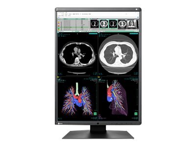 EIZO RadiForce RX360-DH-NM200 - LED monitor - 3MP - color - 21.3" - with NV