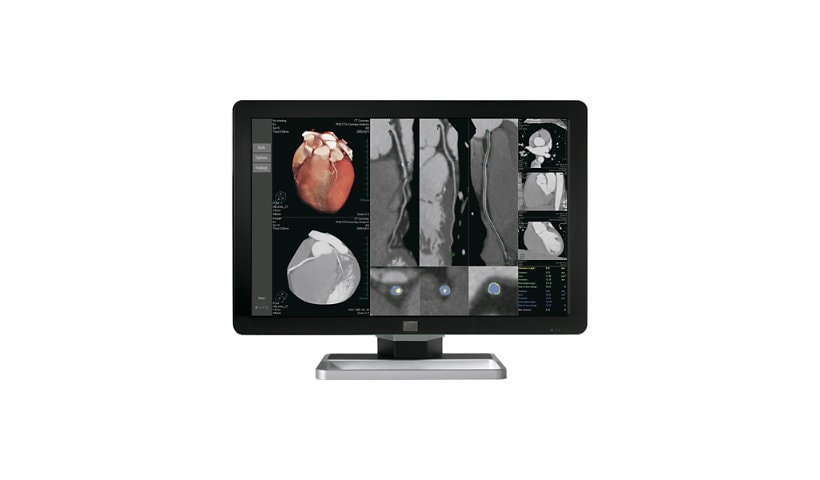 HP Barco Coronis Fusion 6MP LED MXRT-5600 Medical Display System