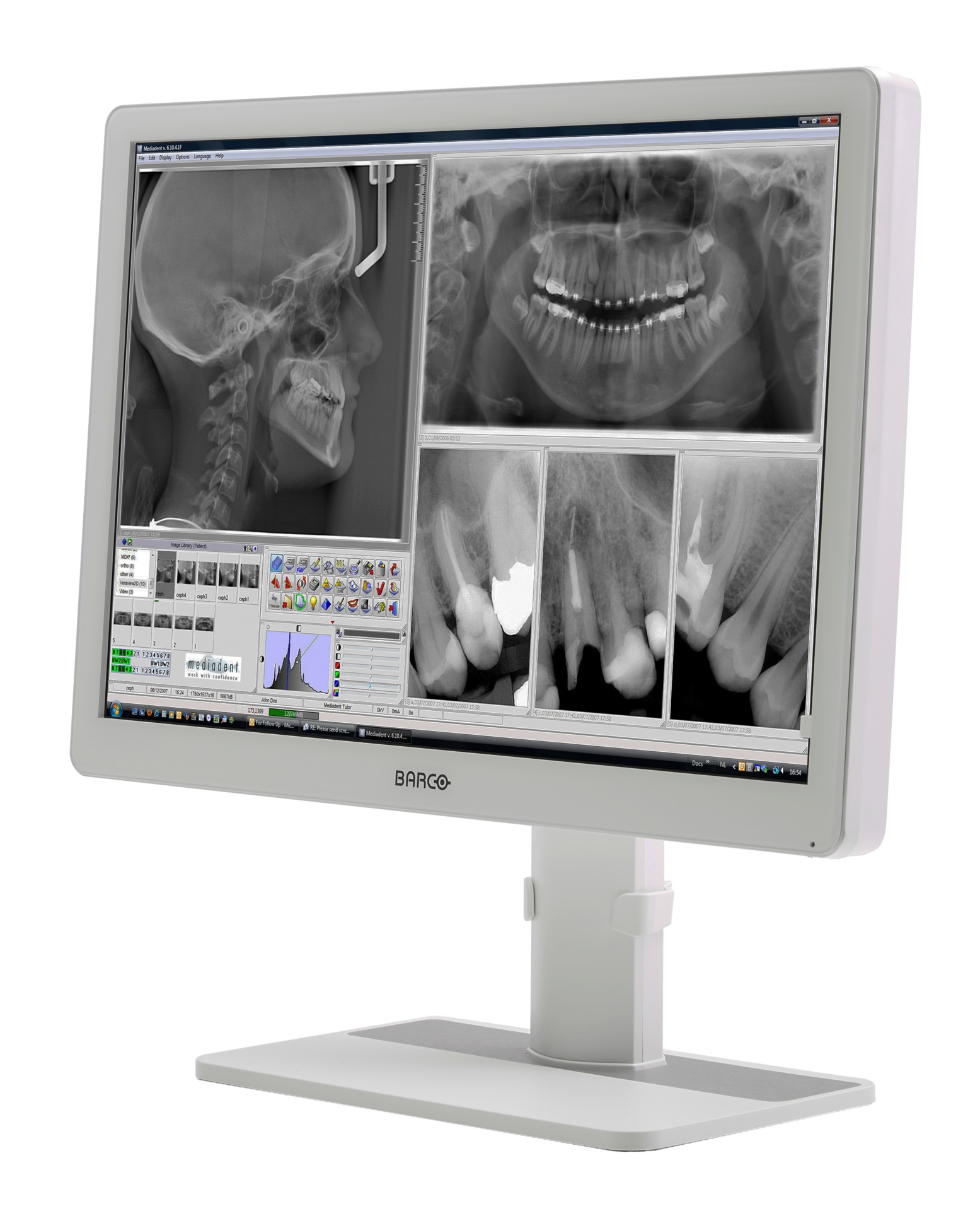 Barco Eonis MDRC-2324 - LED monitor - 2MP - color - 24"