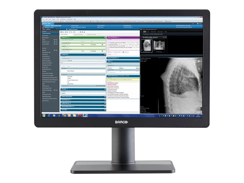 Barco Eonis MDRC-2324 SNIB 24" LCD Clinical Review Display