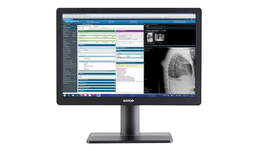Barco Eonis MDRC-2324 SNIB 24" LCD Clinical Review Display