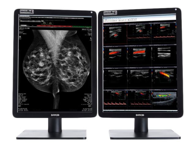 Barco Nio Color 5MP MDNC-6121 - LED monitor - 2 x 5.8MP - color - 21.3"