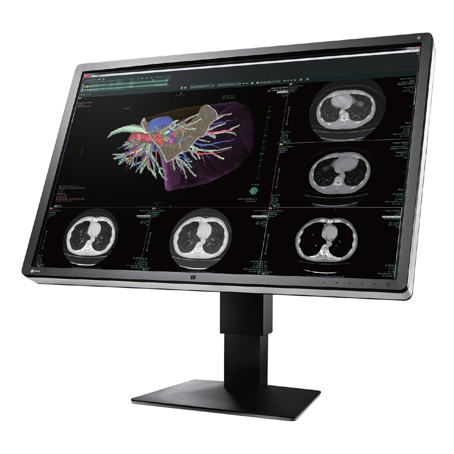 EIZO RadiForce RX660 30" 6MP IPS LCD Monitor - Black