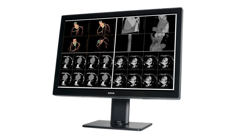 Barco Coronis Fusion 6MP MDCC-6530 Medical Display with MXRT-5600