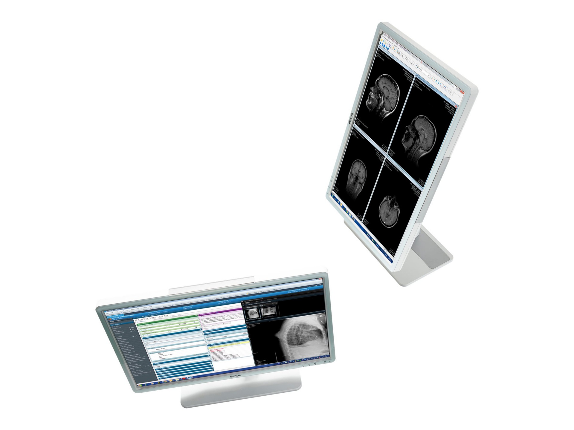 Thumbnail 2 of 2 for Barco Eonis MDRC-2324 HNEW - LED monitor - 2MP - color - 24"