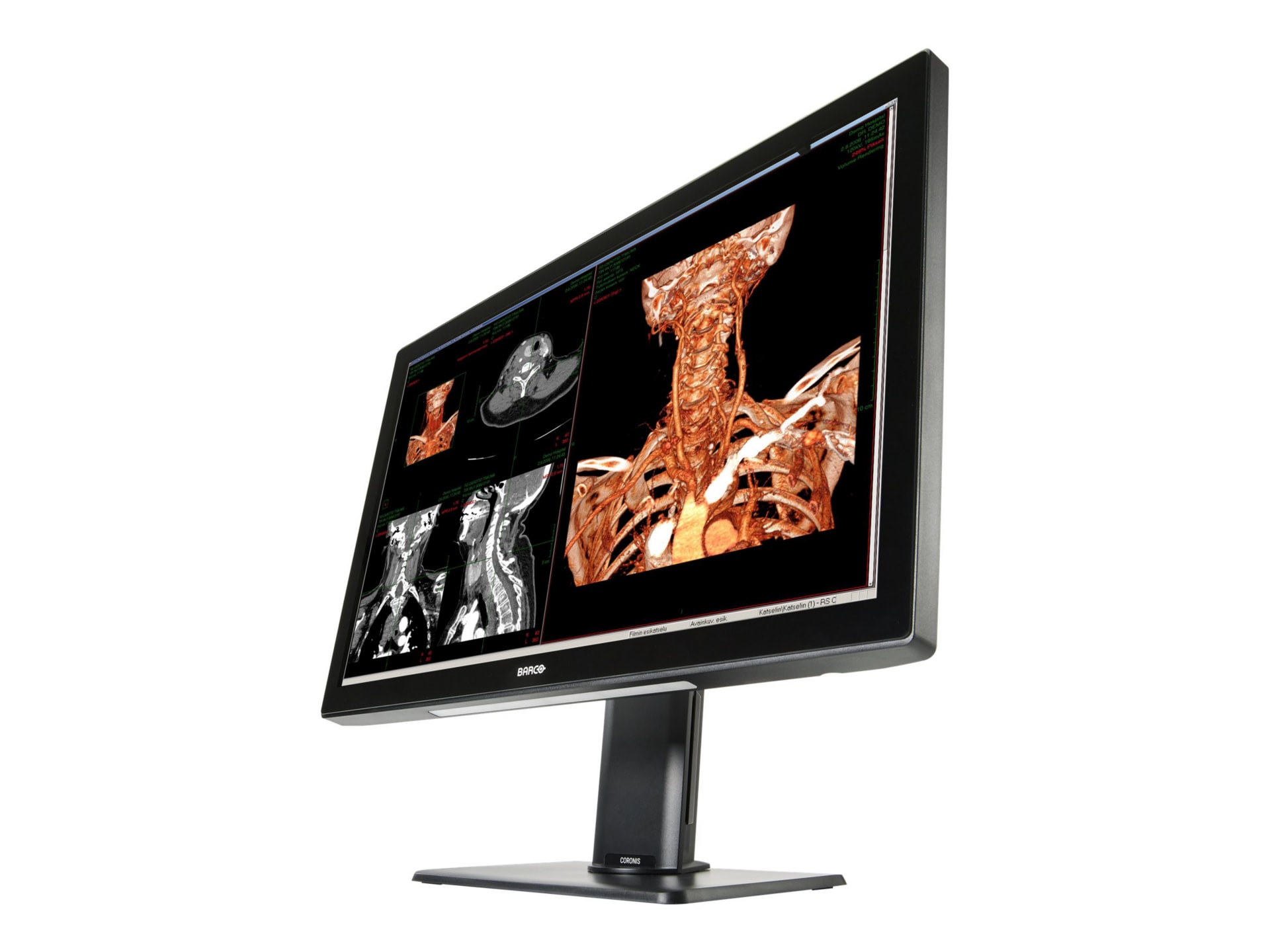 Barco Coronis Fusion 6MP MDCC-6530 - LED monitor - 6MP - color - 30.4" - with Barco MXRT-6700 graphics adapter