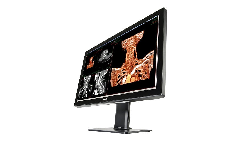 Barco Coronis Fusion 6MP MDCC-6530 - LED monitor - 2 x 6MP - color - 30.4" - with Barco MXRT-6700 graphics adapter