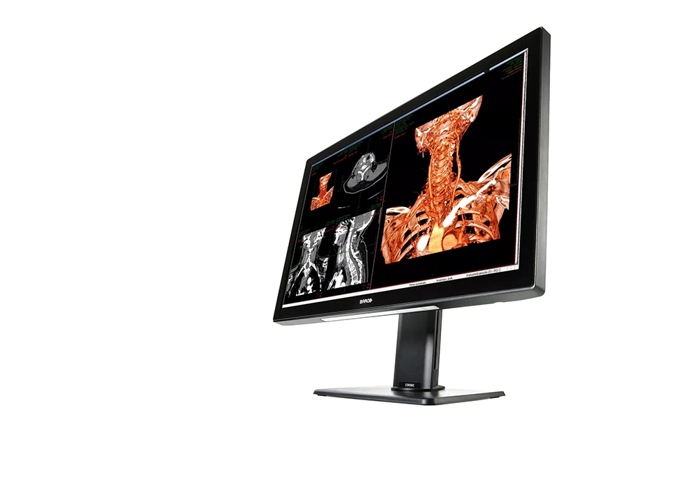 BARCO CORONIS FUSION 6MP 2H NO CARD