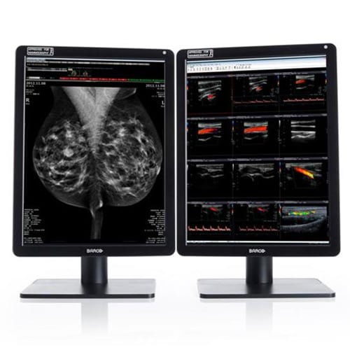 Barco Nio 5.8MP Clear Dual Head Medical Display System