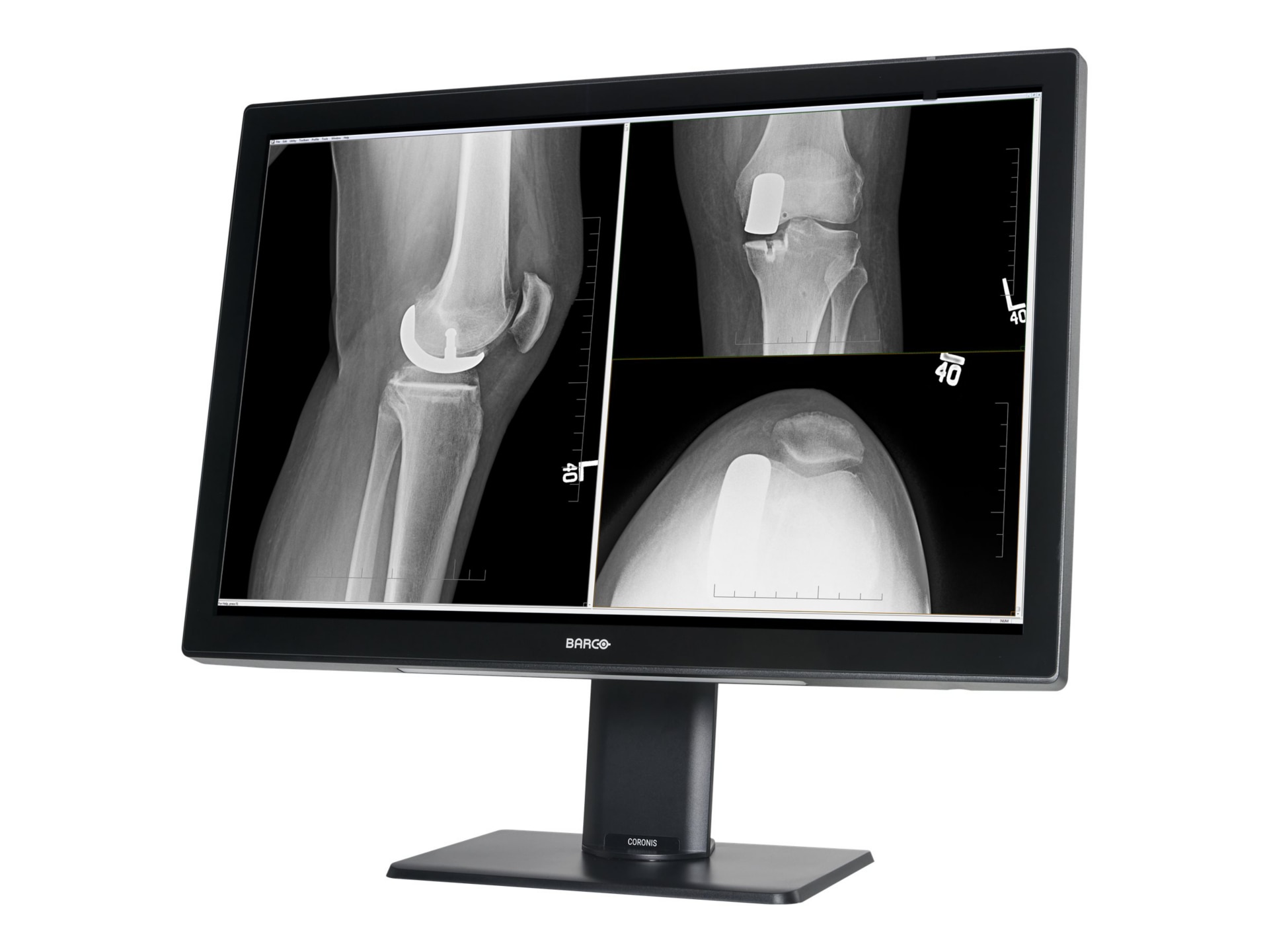 Thumbnail 2 of 5 for Barco Coronis Fusion 4MP (MDCC-4430) - LCD monitor - 4MP - color - 30.4" - with Barco MXRT-6700 graphics adapter