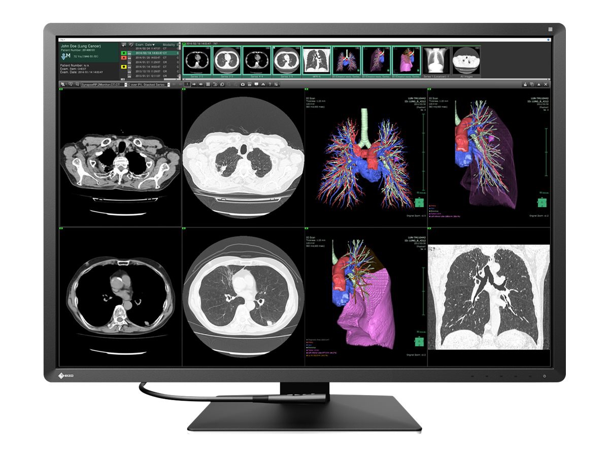 EIZO RadiForce RX1270 - LED monitor - 12MP - color - 30.9"