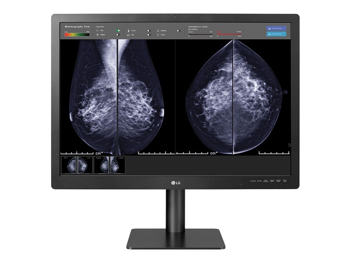 LG 31'' 12MP 4200 x 2800 IPS Diagnostic Monitor for Mammography l 31HN713D  l LG GLOBAL